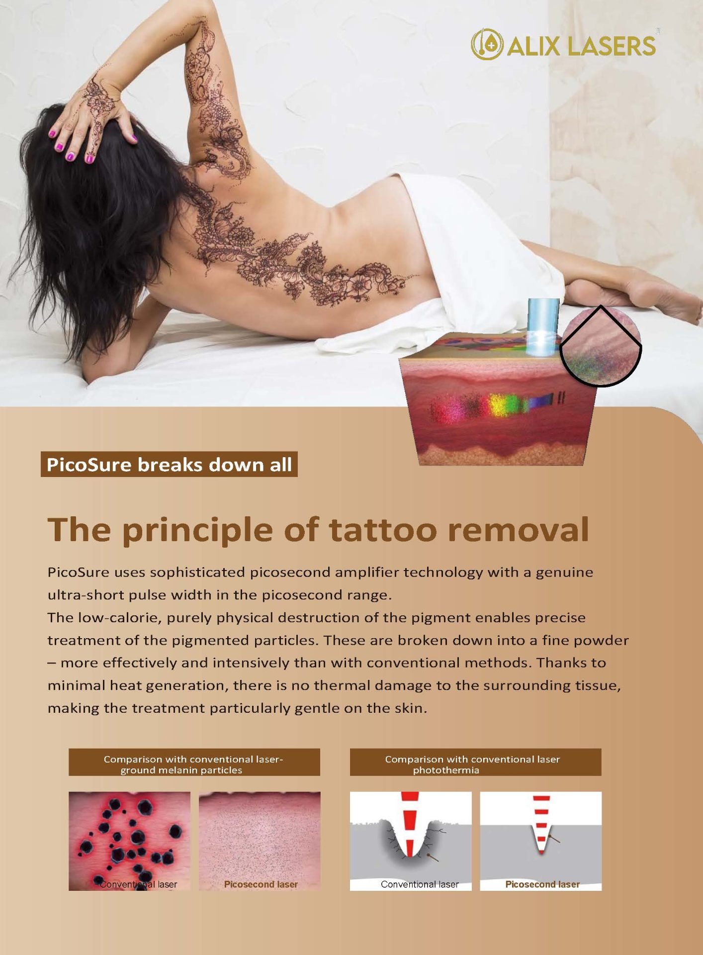 Pico Laser Tattooentfernung Prinzip